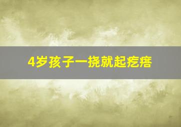 4岁孩子一挠就起疙瘩