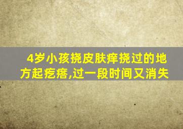 4岁小孩挠皮肤痒挠过的地方起疙瘩,过一段时间又消失