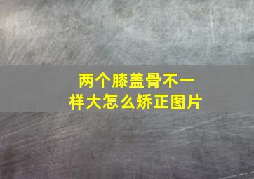 两个膝盖骨不一样大怎么矫正图片