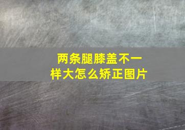 两条腿膝盖不一样大怎么矫正图片