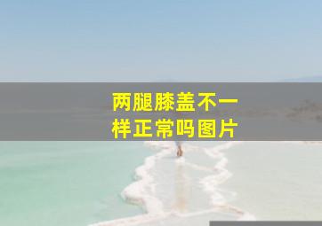 两腿膝盖不一样正常吗图片