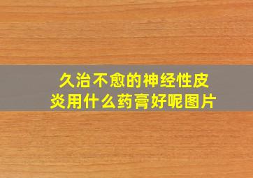 久治不愈的神经性皮炎用什么药膏好呢图片