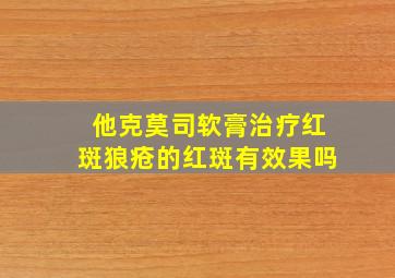 他克莫司软膏治疗红斑狼疮的红斑有效果吗