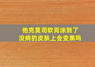 他克莫司软膏涂到了没病的皮肤上会变黑吗