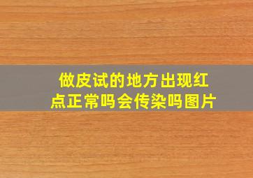 做皮试的地方出现红点正常吗会传染吗图片