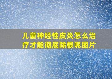 儿童神经性皮炎怎么治疗才能彻底除根呢图片