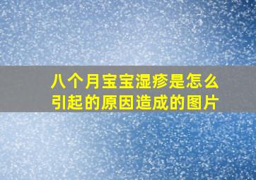 八个月宝宝湿疹是怎么引起的原因造成的图片