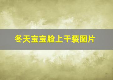 冬天宝宝脸上干裂图片