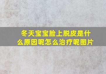 冬天宝宝脸上脱皮是什么原因呢怎么治疗呢图片