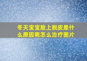 冬天宝宝脸上脱皮是什么原因呢怎么治疗图片