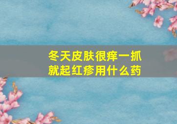 冬天皮肤很痒一抓就起红疹用什么药