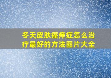 冬天皮肤瘙痒症怎么治疗最好的方法图片大全