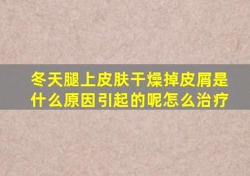 冬天腿上皮肤干燥掉皮屑是什么原因引起的呢怎么治疗