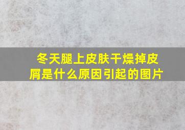 冬天腿上皮肤干燥掉皮屑是什么原因引起的图片