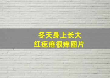 冬天身上长大红疙瘩很痒图片