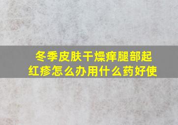 冬季皮肤干燥痒腿部起红疹怎么办用什么药好使