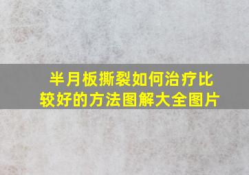 半月板撕裂如何治疗比较好的方法图解大全图片