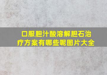 口服胆汁酸溶解胆石治疗方案有哪些呢图片大全