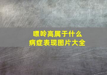 嘌呤高属于什么病症表现图片大全