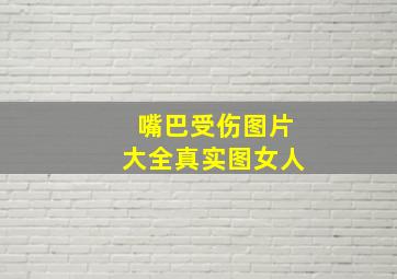 嘴巴受伤图片大全真实图女人