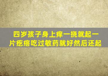 四岁孩子身上痒一挠就起一片疙瘩吃过敏药就好然后还起