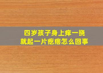 四岁孩子身上痒一挠就起一片疙瘩怎么回事