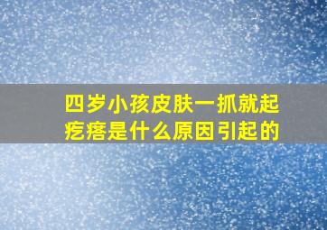 四岁小孩皮肤一抓就起疙瘩是什么原因引起的