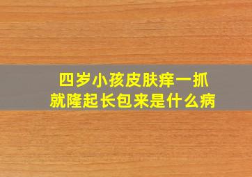 四岁小孩皮肤痒一抓就隆起长包来是什么病