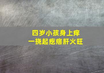 四岁小孩身上痒一挠起疙瘩肝火旺