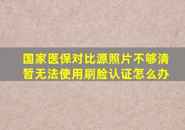 国家医保对比源照片不够清暂无法使用刷脸认证怎么办