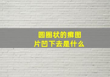 圆圈状的癣图片凹下去是什么