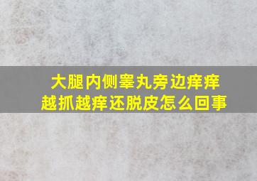 大腿内侧睾丸旁边痒痒越抓越痒还脱皮怎么回事