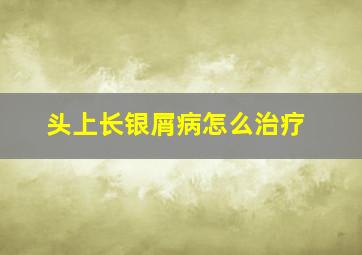 头上长银屑病怎么治疗