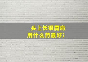 头上长银屑病用什么药最好冫