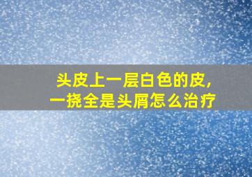 头皮上一层白色的皮,一挠全是头屑怎么治疗