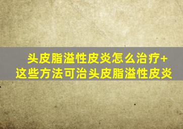 头皮脂溢性皮炎怎么治疗+这些方法可治头皮脂溢性皮炎