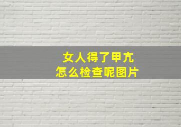 女人得了甲亢怎么检查呢图片