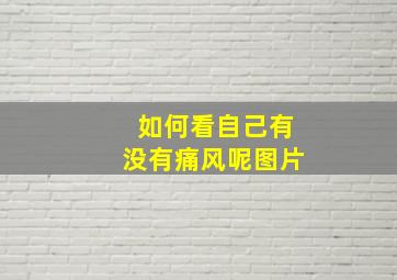 如何看自己有没有痛风呢图片