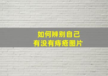 如何辨别自己有没有痔疮图片