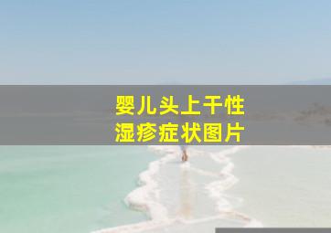 婴儿头上干性湿疹症状图片