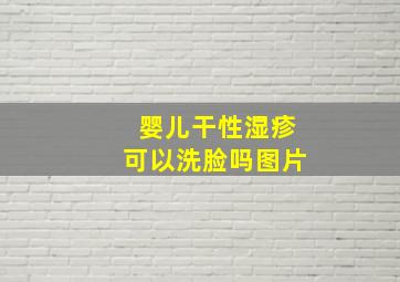 婴儿干性湿疹可以洗脸吗图片