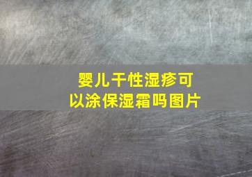 婴儿干性湿疹可以涂保湿霜吗图片