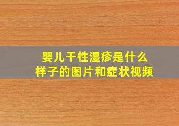 婴儿干性湿疹是什么样子的图片和症状视频