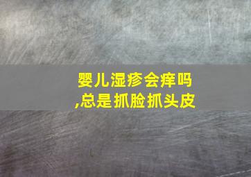 婴儿湿疹会痒吗,总是抓脸抓头皮