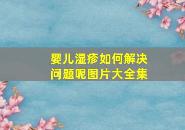 婴儿湿疹如何解决问题呢图片大全集