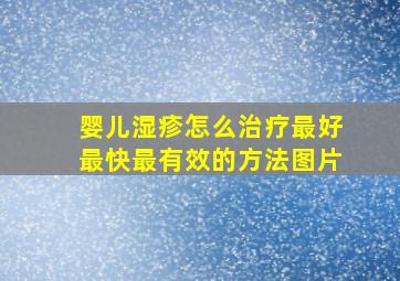 婴儿湿疹怎么治疗最好最快最有效的方法图片