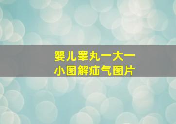 婴儿睾丸一大一小图解疝气图片