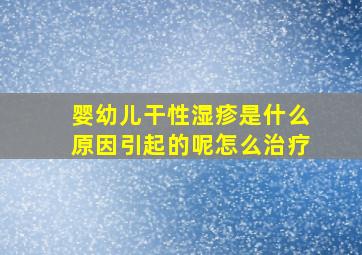 婴幼儿干性湿疹是什么原因引起的呢怎么治疗