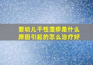 婴幼儿干性湿疹是什么原因引起的怎么治疗好