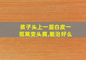 孩子头上一层白皮一抠就变头屑,能治好么